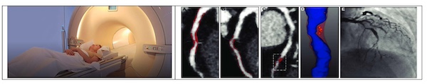 Know How To Detect Heart Disease In Advance 